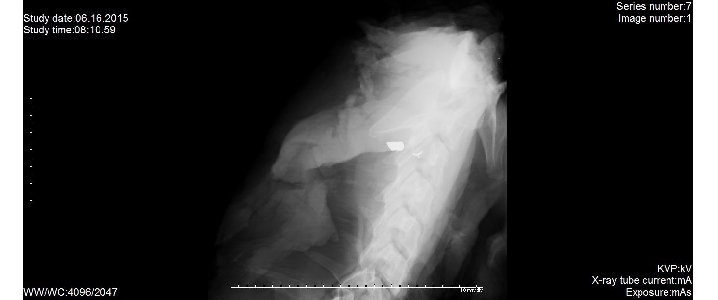 Pocisk widoczny na zdjęciu rentgenowskim szyi. Projekcja strzałkowa celowana.